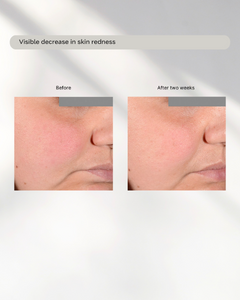 Modern Age Skin - The Innovator Deep Moisturizing Serum