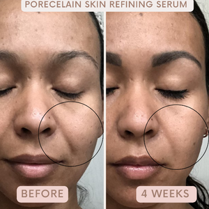 Avue Beauty - Skin Refining Serum
