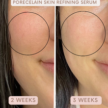 Load image into Gallery viewer, Avue Beauty - Skin Refining Serum
